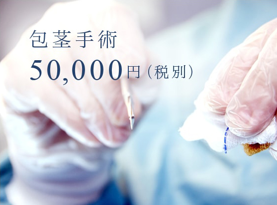 包茎手術50,000円（税別）